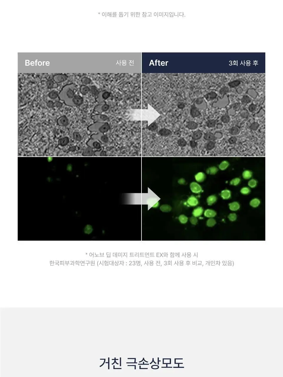 [열보호] 어노브 히팅 가드 노워시 트리트먼트 147ml (극손상모 열케어 헤어팩) 상세페이지 17